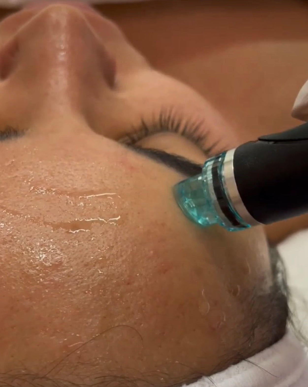 Platinum Hydrafacial